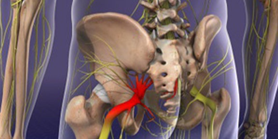 Sciatica Care Boise